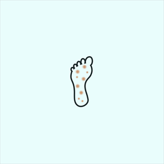 Neuropathy